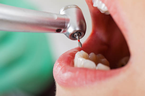 Best Urgent Tooth Repair  in Indian River Estates, FL
